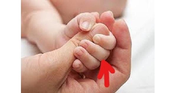 Image Based Question