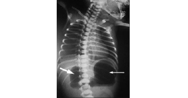 Image Based Question