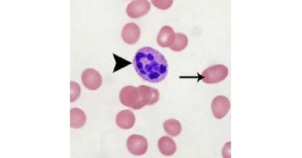 Image Based Question