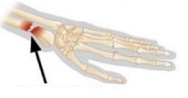 Image Based Question