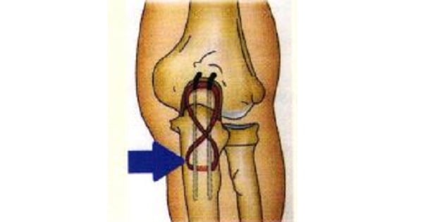 Image Based Question