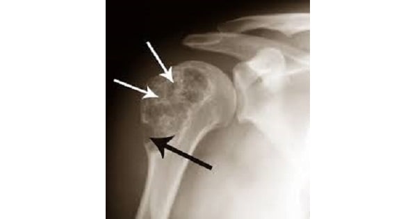 Image Based Question