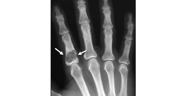 Image Based Question