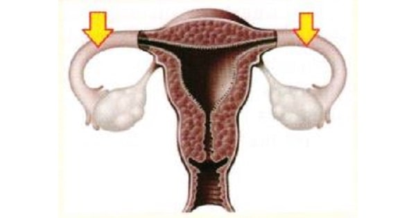 Image Based Question