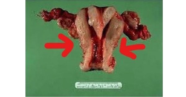 Image Based Question