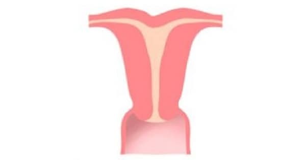 Image Based Question