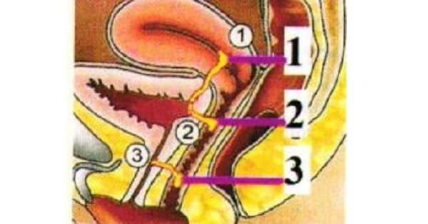 Image Based Question