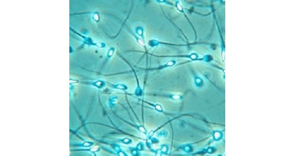 Image Based Question