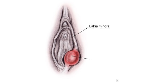 Image Based Question