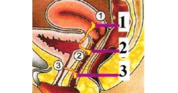 Image Based Question
