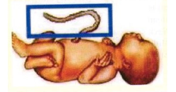 Image Based Question