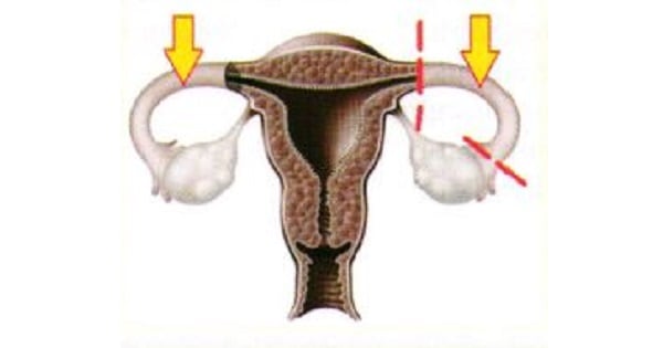 Image Based Question