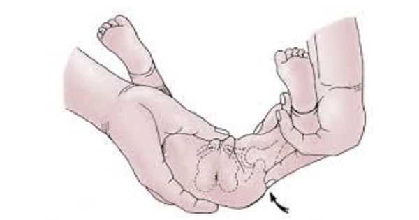 Image Based Question