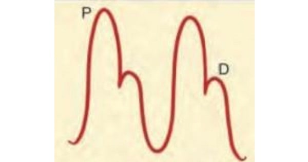 Image Based Question