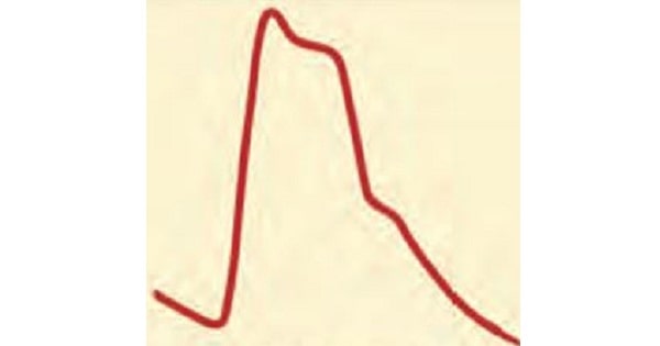 Image Based Question