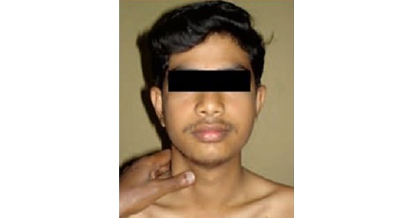Image Based Question