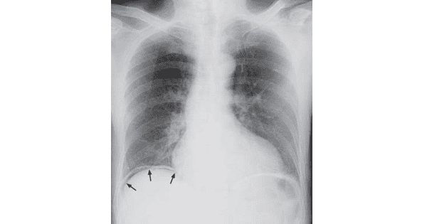 Image Based Question