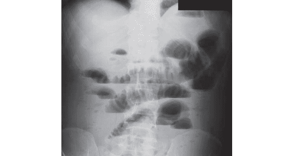 Image Based Question