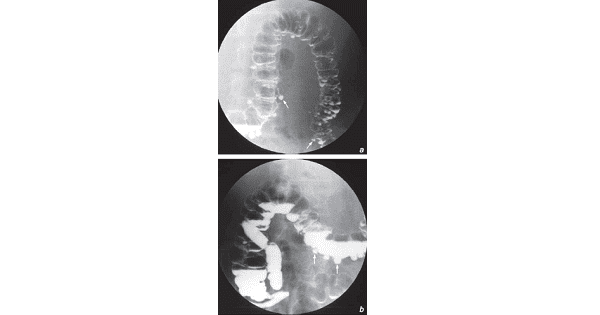 Image Based Question