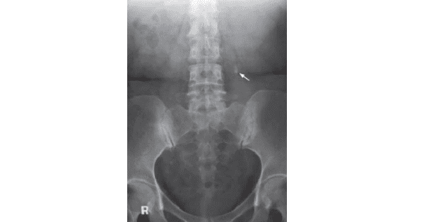Image Based Question