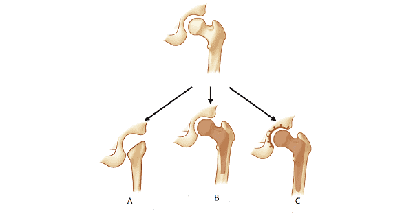 Image Based Question