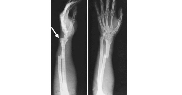 Image Based Question