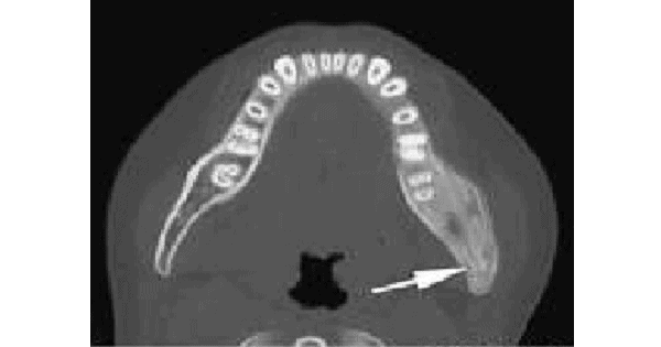 Image Based Question