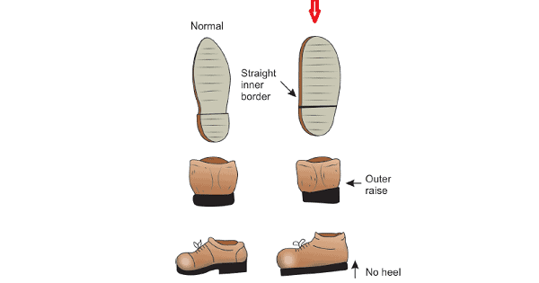 Image Based Question