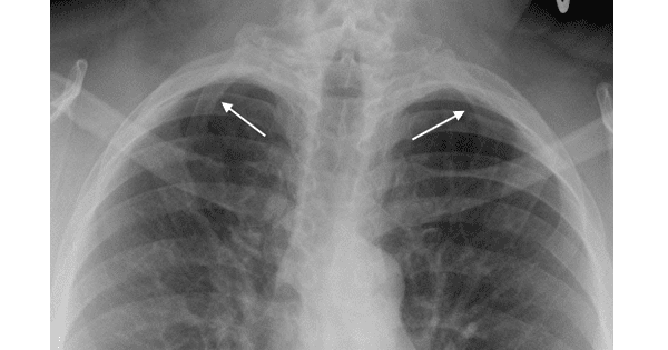 Image Based Question