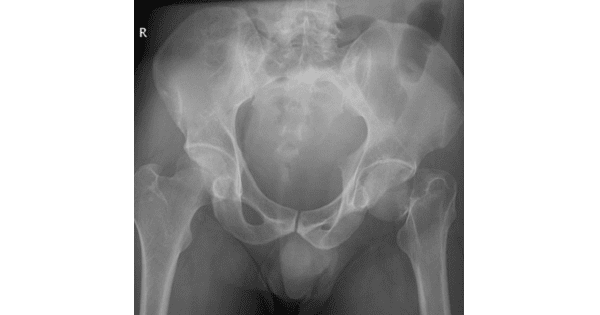 Image Based Question
