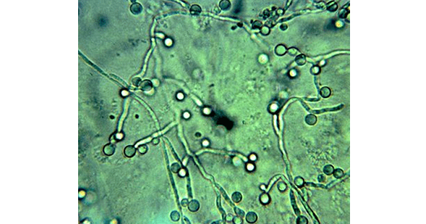 Image Based Question