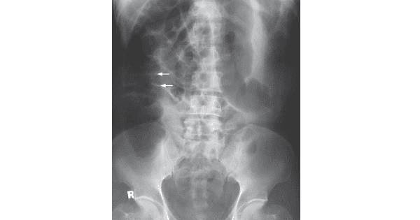 Image Based Question